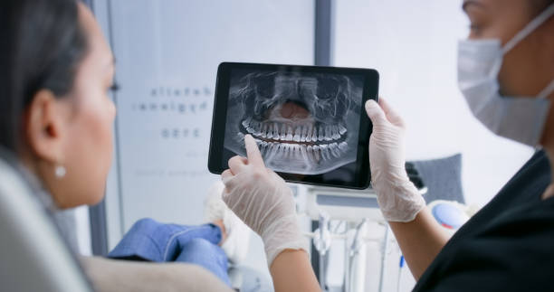 Licensed Dental Implants service in Ipswich, SD - Smile Center Dentistry